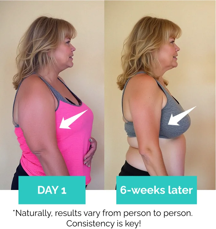MyoGlow before and after arm results at 6 weeks